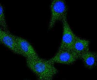 Immunocytochemistry/ Immunofluorescence: VEGFR1/Flt-1 Antibody (SY09-09) [NBP3-11864]