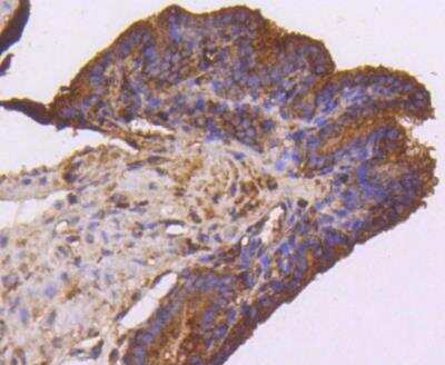 Immunohistochemistry-Paraffin: VEGFR1/Flt-1 Antibody (SY09-09) [NBP3-11864]
