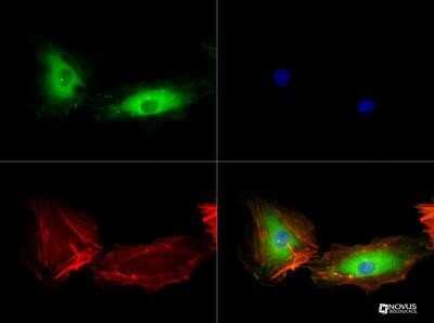Immunocytochemistry/ Immunofluorescence: VEGFR2/KDR/Flk-1 Antibody (1B6) - Azide and BSA Free [NBP2-81008]