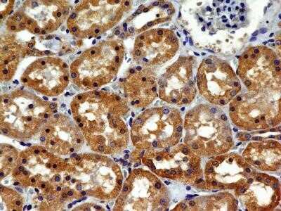 Immunohistochemistry-Paraffin: VEGFR2/KDR/Flk-1 Antibody (1B6) - Azide and BSA Free [NBP2-81008]