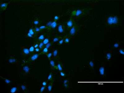 Immunocytochemistry/ Immunofluorescence: VEGFR2/KDR/Flk-1 Antibody (20I6) - Azide and BSA Free [NBP1-18646]