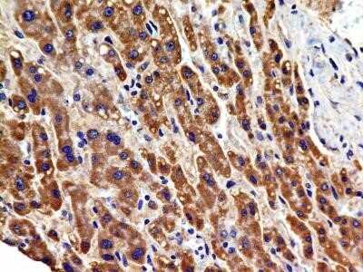 Immunocytochemistry: VEGFR2/KDR/Flk-1 Antibody (2C6) - Azide and BSA Free [NBP2-81009]