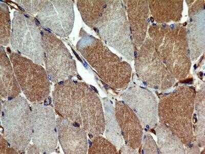 Immunohistochemistry: VEGFR2/KDR/Flk-1 Antibody (2C6) - Azide and BSA Free [NBP2-81009]