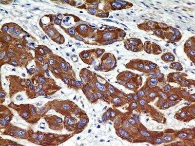 Immunohistochemistry-Paraffin: VEGFR2/KDR/Flk-1 Antibody (2C6) - Azide and BSA Free [NBP2-81009]