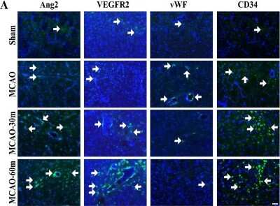 Immunocytochemistry/ Immunofluorescence: VEGFR2/KDR/Flk-1 Antibody [NB100-530]