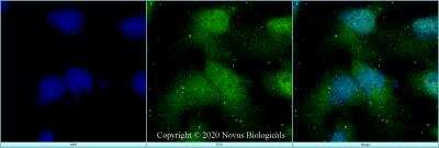 Immunocytochemistry/ Immunofluorescence: VEGFR2/KDR/Flk-1 Antibody - BSA Free [NBP3-05772]