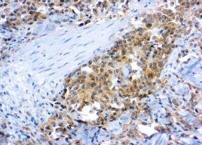 Immunohistochemistry-Paraffin: VEGFR2/KDR/Flk-1 Antibody [NB100-686]