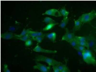 Immunocytochemistry/ Immunofluorescence: VEGFR3/Flt-4 Antibody (7A3) - Azide and BSA Free [NBP1-18653]