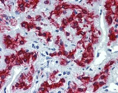 Immunohistochemistry: VEZF1 Antibody [NBP1-80115]