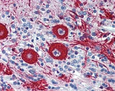 Immunohistochemistry: VEZF1 Antibody [NBP1-80115]