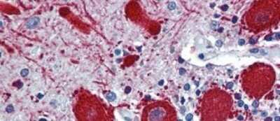 Immunohistochemistry-Paraffin: VEZF1 Antibody [NBP1-80115]