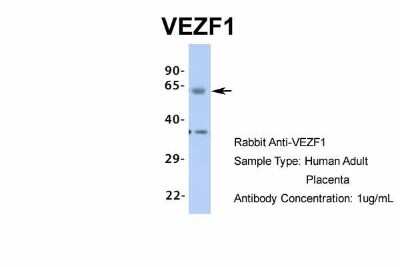 Western Blot: VEZF1 Antibody [NBP1-80115]