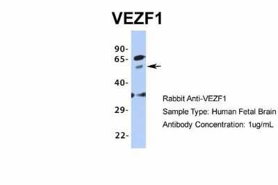 Western Blot: VEZF1 Antibody [NBP1-80115]