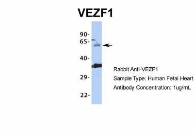 Western Blot: VEZF1 Antibody [NBP1-80115]