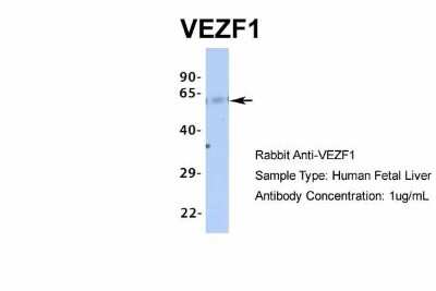 Western Blot: VEZF1 Antibody [NBP1-80115]