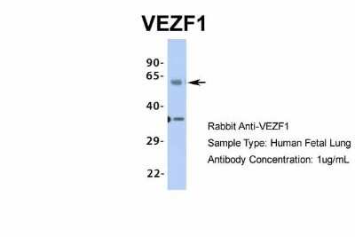 Western Blot: VEZF1 Antibody [NBP1-80115]