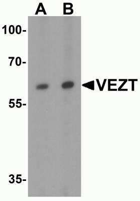 Western Blot: VEZT AntibodyBSA Free [NBP2-82044]