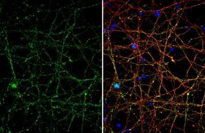 Immunocytochemistry/ Immunofluorescence: VGLUT1 Antibody [NBP3-13165]