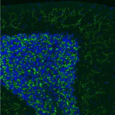 Immunohistochemistry: VGLUT2 Antibody (CL2921) [NBP2-46640]