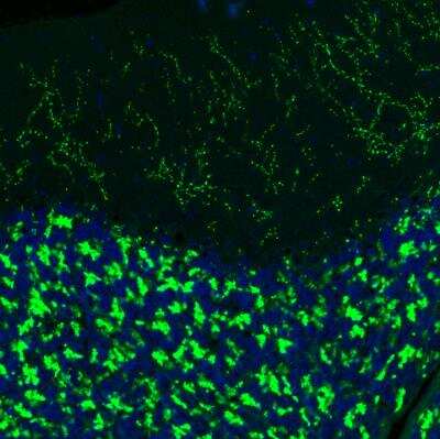 Immunohistochemistry: VGLUT2 Antibody (CL2921) [NBP2-46640]
