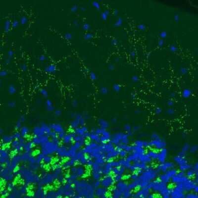 Immunohistochemistry: VGLUT2 Antibody (CL2952) [NBP2-46641]
