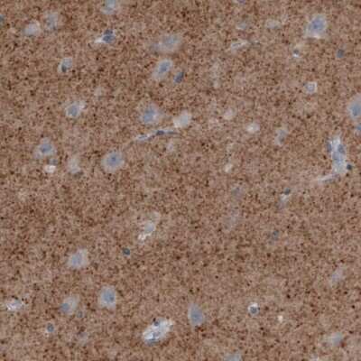 Immunohistochemistry-Paraffin: VGLUT2 Antibody (CL2952) [NBP2-46641]