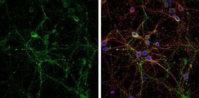 Immunocytochemistry/ Immunofluorescence: VGLUT2 Antibody [NBP3-13164]