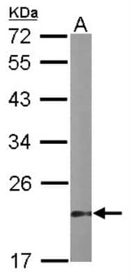 Western Blot: VHR/DUSP3 Antibody [NBP1-33099]