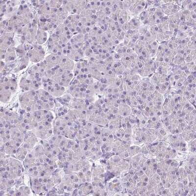 Immunohistochemistry-Paraffin: VIAAT/SLC32A1/VGAT Antibody [NBP2-34117]