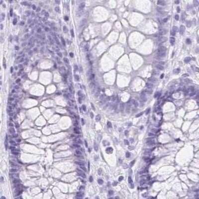 Immunohistochemistry-Paraffin: VIAAT/SLC32A1/VGAT Antibody [NBP2-34117]
