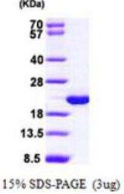 SDS-PAGE: Recombinant Human VILIP3 His Protein [NBP1-48588]