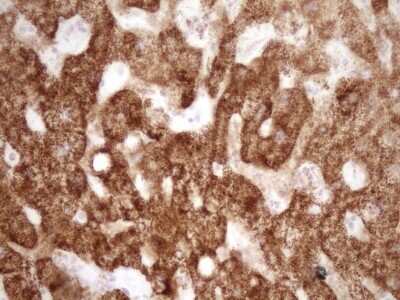 Immunohistochemistry: VIP Antibody (OTI1E8) [NBP2-46349]