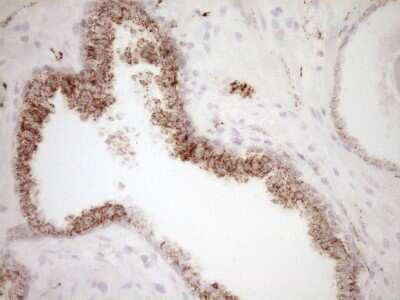 Immunohistochemistry: VIP Antibody (OTI1E8) [NBP2-46349]
