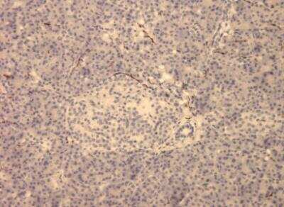 Immunohistochemistry-Paraffin: VIP Antibody (2) - BSA Free [NBP1-05163]