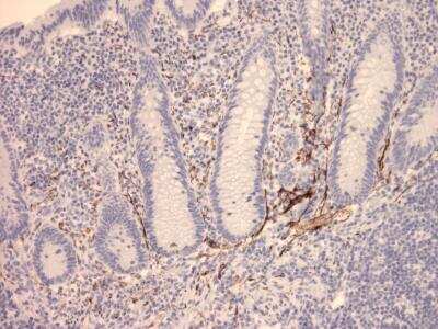 Immunohistochemistry-Paraffin: VIP Antibody (2) - BSA Free [NBP1-05163]