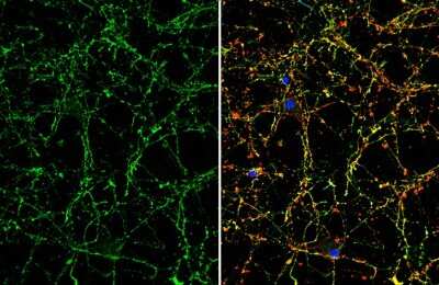 Immunocytochemistry/ Immunofluorescence: VIP Antibody [NBP3-12899]