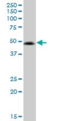 Western Blot: VIPR2/VPAC2 Antibody (2E3) [H00007434-M01]