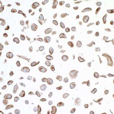 Immunocytochemistry/ Immunofluorescence: VISTA/B7-H5/PD-1H Antibody (BLR035F) [NBP2-76406]
