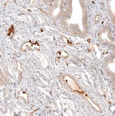 Immunohistochemistry-Paraffin: VISTA/B7-H5/PD-1H Antibody [NBP1-88967]