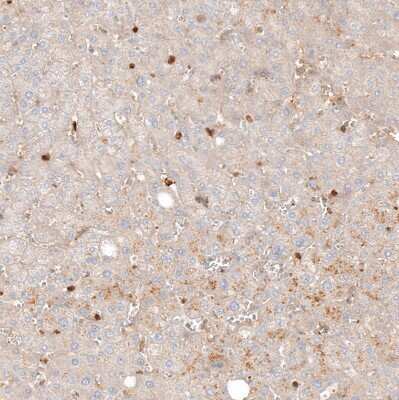 Immunohistochemistry-Paraffin: VISTA/B7-H5/PD-1H Antibody [NBP1-88967]