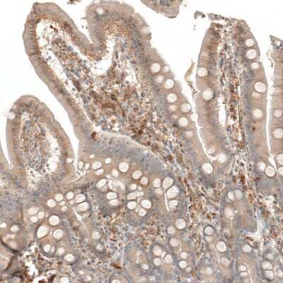 Immunohistochemistry-Paraffin: VISTA/B7-H5/PD-1H Antibody [NBP1-88967]