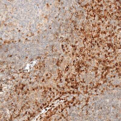 Immunohistochemistry-Paraffin: VISTA/B7-H5/PD-1H Antibody [NBP1-88967]