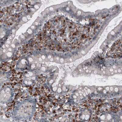 Immunohistochemistry-Paraffin: VISTA/B7-H5/PD-1H Antibody (CL3981) [NBP2-59031]