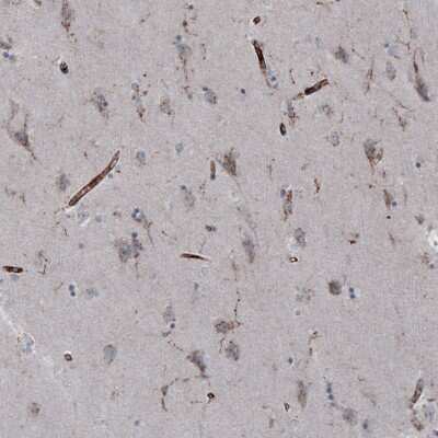 Immunohistochemistry-Paraffin: VISTA/B7-H5/PD-1H Antibody (CL3981) [NBP2-59031]