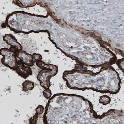 Immunohistochemistry-Paraffin: VISTA/B7-H5/PD-1H Antibody (CL3981) [NBP2-59031]