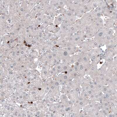 Immunohistochemistry-Paraffin: VISTA/B7-H5/PD-1H Antibody (CL3981) [NBP2-59031]