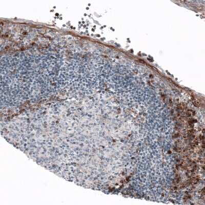 Immunohistochemistry-Paraffin: VISTA/B7-H5/PD-1H Antibody (CL3981) [NBP2-59031]