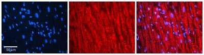 Immunohistochemistry-Paraffin: VKORC1 Antibody [NBP2-83750]