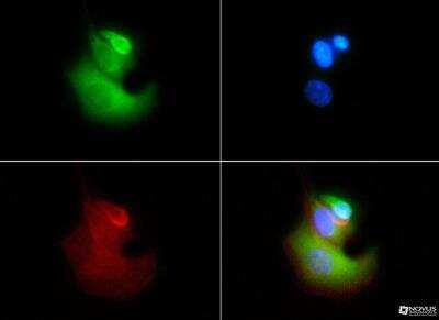 Immunocytochemistry/ Immunofluorescence: VLDLR Antibody (6A6) - BSA Free [NBP1-78162]
