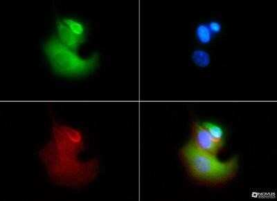 Immunocytochemistry/ Immunofluorescence: VLDLR Antibody (6A6) - Azide and BSA Free [NBP2-81010]